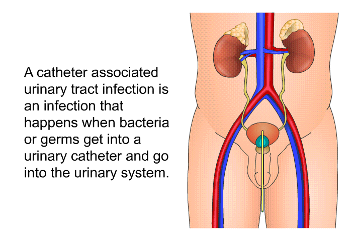 A catheter associated urinary tract infection is an infection that happens when bacteria or germs get into a urinary catheter and go into the urinary system.