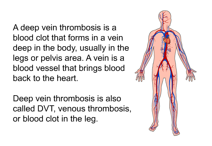A deep vein thrombosis is a blood clot that forms in a vein deep in the body, usually in the legs or pelvis area. A vein is a blood vessel that brings blood back to the heart. Deep vein thrombosis is also called DVT, venous thrombosis, or blood clot in the leg.