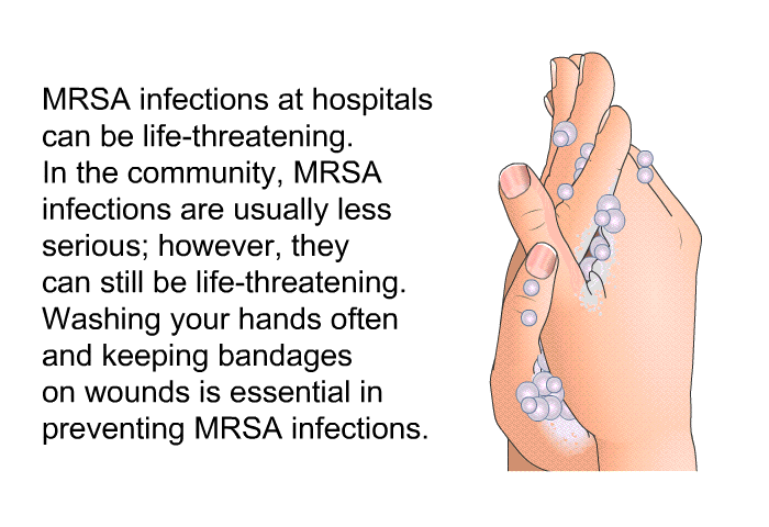 MRSA infections at hospitals can be life-threatening. In the community, MRSA infections are usually less serious; however, they can still be life-threatening. Washing your hands often and keeping bandages on wounds is essential in preventing MRSA infections.