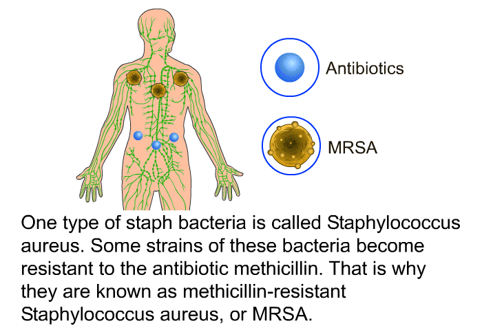 One type of staph bacteria is called <I>Staphylococcus aureus</I>. Some strains of these bacteria become resistant to the antibiotic methicillin. That is why they are known as methicillin-resistant <I>Staphylococcus aureus</I>, or MRSA.