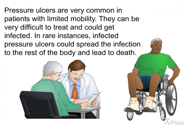 Pressure ulcers are very common in patients with limited mobility. They can be very difficult to treat and could get infected. In rare instances, infected pressure ulcers could spread the infection to the rest of the body and lead to death.