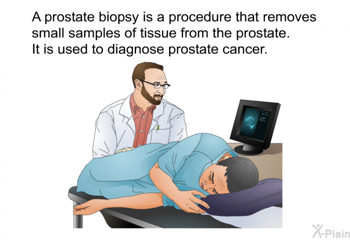 A prostate biopsy is a procedure that removes small samples of tissue from the prostate. It is used to diagnose prostate cancer.