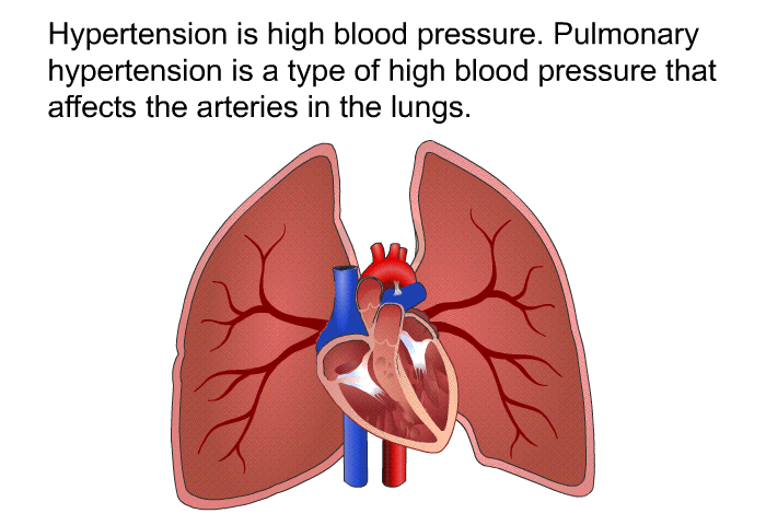 Hypertension is high blood pressure. Pulmonary hypertension is a type of high blood pressure that affects the arteries in the lungs.