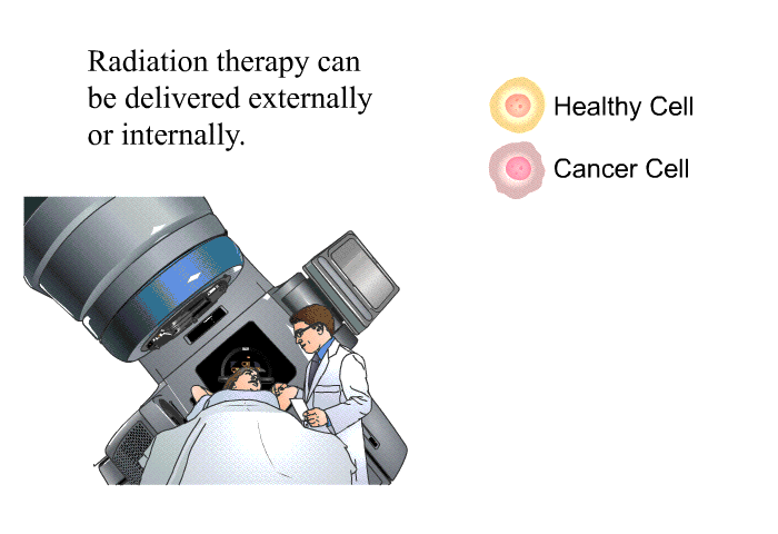 Radiation therapy can be delivered externally or internally.