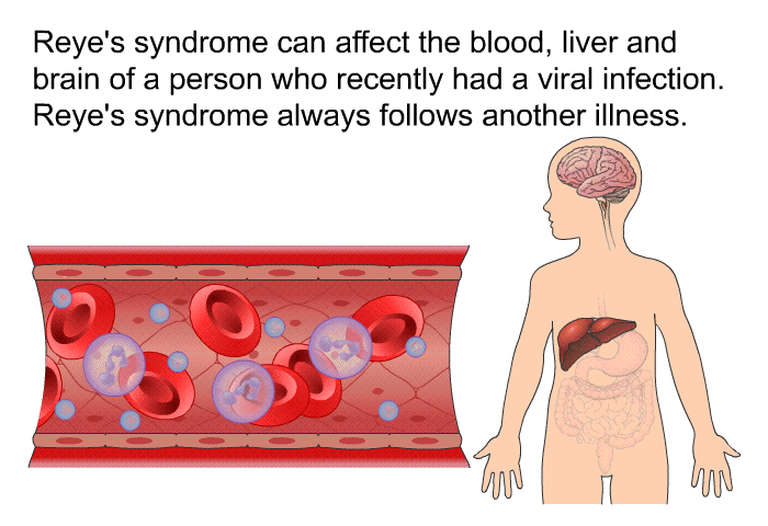 Reye's syndrome can affect the blood, liver and brain of a person who recently had a viral infection. Reye's syndrome always follows another illness.