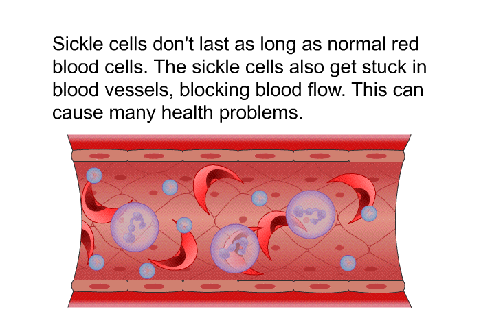 Sickle cells don't last as long as normal red blood cells. The sickle cells also get stuck in blood vessels, blocking blood flow. This can cause many health problems.