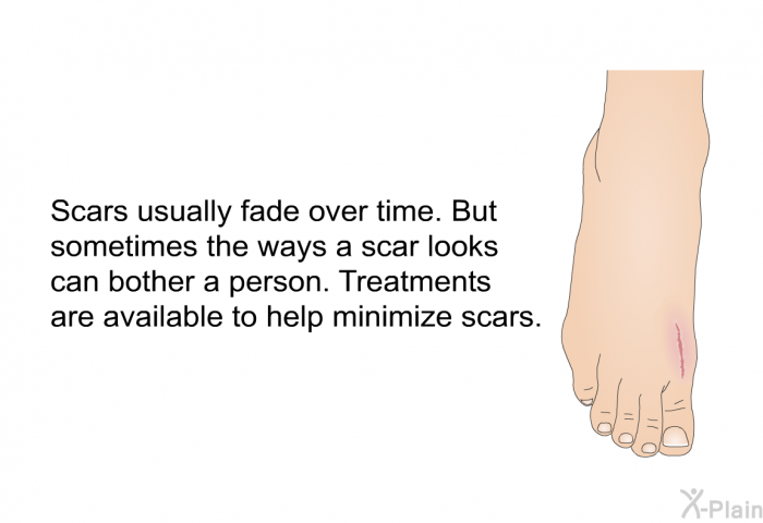 Scars usually fade over time. But sometimes the ways a scar looks can bother a person. Treatments are available to help minimize scars.