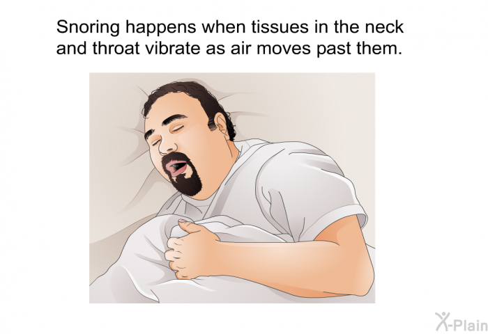 Snoring happens when tissues in the neck and throat vibrate as air moves past them.