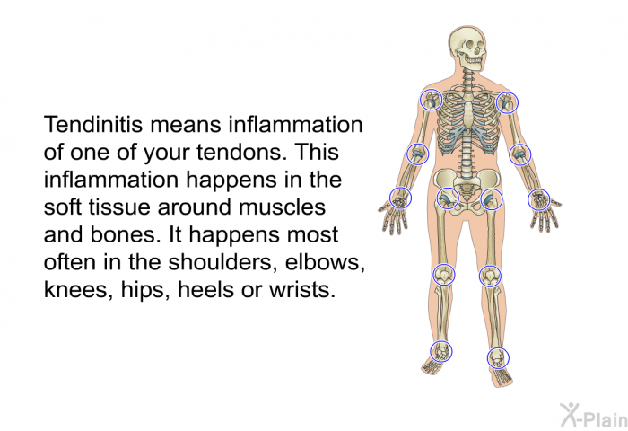 Tendinitis means inflammation of one of your tendons. This inflammation happens in the soft tissue around muscles and bones. It happens most often in the shoulders, elbows, knees, hips, heels or wrists.
