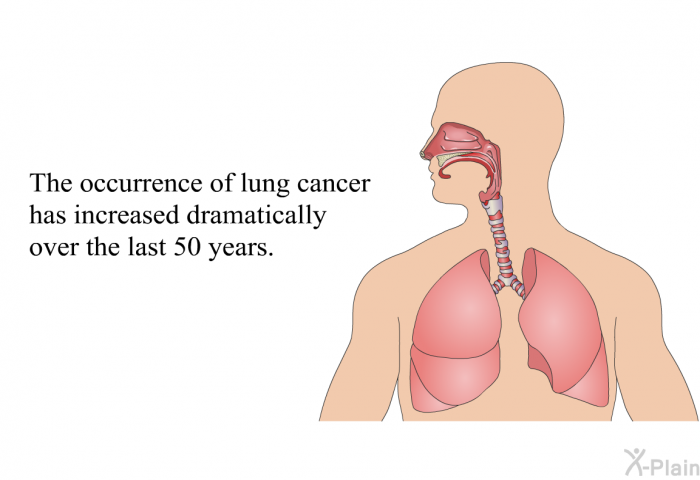 The occurrence of lung cancer has increased dramatically over the last 50 years.