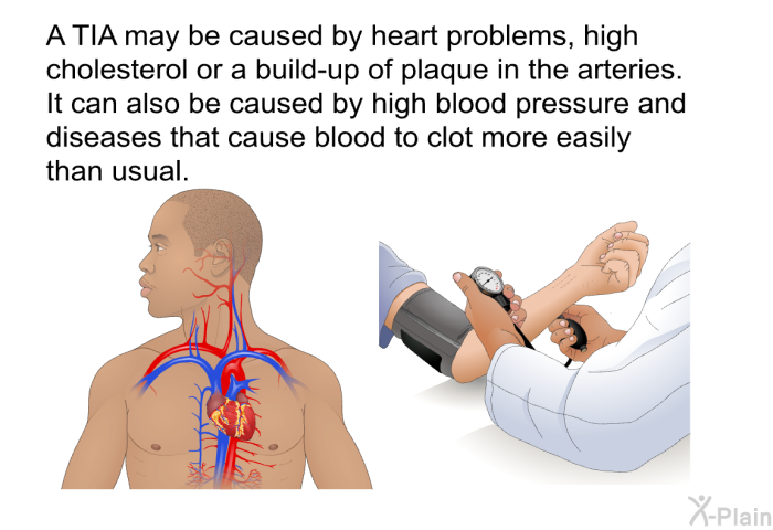 A TIA may be caused by heart problems, high cholesterol or a build-up of plaque in the arteries. It can also be caused by high blood pressure and diseases that cause blood to clot more easily than usual.