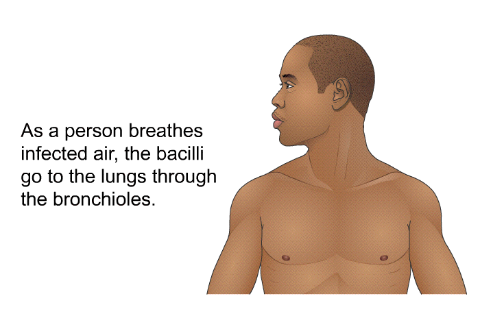 As a person breathes infected air, the bacilli go to the lungs through the bronchioles.