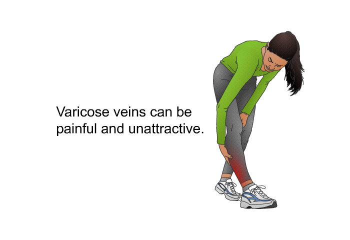 Varicose veins can be painful and unattractive.