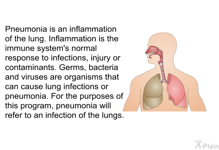 Pneumonia is an inflammation of the lung. Inflammation is the immune system's normal response to infections, injury or contaminants. Germs, bacteria and viruses are organisms that can cause lung infections or pneumonia. For the purposes of this program, pneumonia will refer to an infection of the lungs.