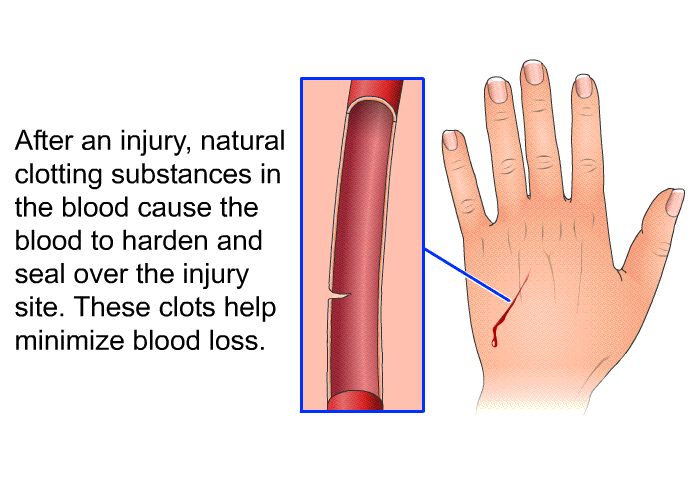 After an injury, natural clotting substances in the blood cause the blood to harden and seal over the injury site. These clots help minimize blood loss.