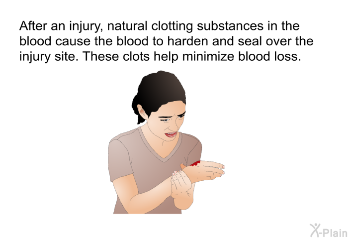 After an injury, natural clotting substances in the blood cause the blood to harden and seal over the injury site. These clots help minimize blood loss.