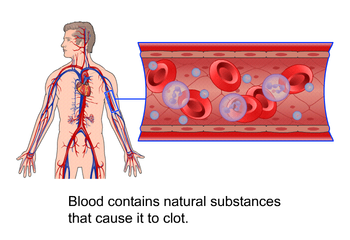 Blood contains natural substances that cause it to clot.