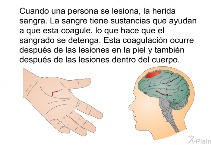 Cuando una persona se lesiona, la herida sangra. La sangre tiene sustancias que ayudan a que esta coagule, lo que hace que el sangrado se detenga. Esta coagulacin ocurre despus de las lesiones en la piel y tambin despus de las lesiones dentro del cuerpo.