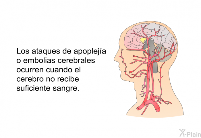 Los ataques de apopleja o embolias cerebrales ocurren cuando el cerebro no recibe suficiente sangre.