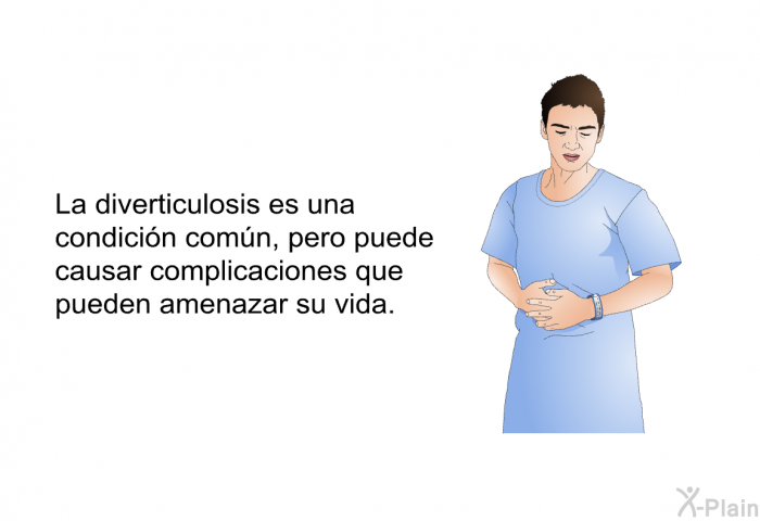 La diverticulosis es una condicin comn, pero puede causar complicaciones que pueden amenazar su vida.