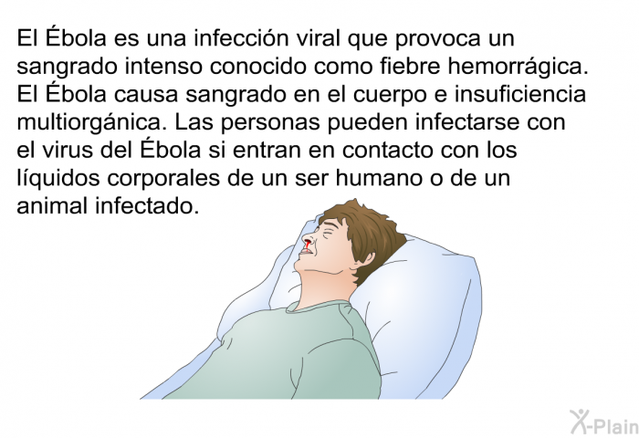 El Ébola es una infeccin viral que provoca un sangrado intenso conocido como fiebre hemorrgica. El Ébola causa sangrado en el cuerpo e insuficiencia multiorgnica. Las personas pueden infectarse con el virus del Ébola si entran en contacto con los lquidos corporales de un ser humano o de un animal infectado.