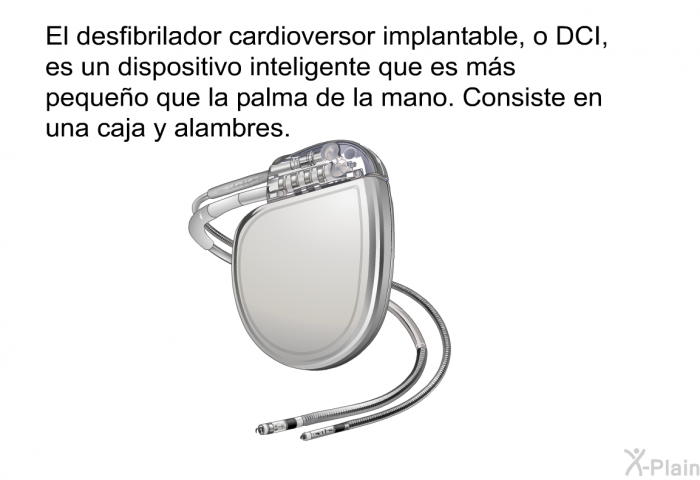 El desfibrilador cardioversor implantable, o DCI, es un dispositivo inteligente que es ms pequeo que la palma de la mano. Consiste en una caja y alambres.