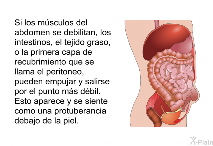 Si los msculos del abdomen se debilitan, los intestinos, el tejido graso, o la primera capa de recubrimiento que se llama el peritoneo, pueden empujar y salirse por el punto ms dbil. Esto aparece y se siente como una protuberancia debajo de la piel.