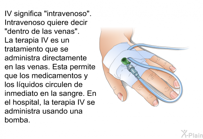IV significa “intravenoso”. Intravenoso quiere decir “dentro de las venas”. La terapia IV es un tratamiento que se administra directamente en las venas. Esta permite que los medicamentos y los lquidos circulen de inmediato en la sangre. En el hospital, la terapia IV se administra usando una bomba.