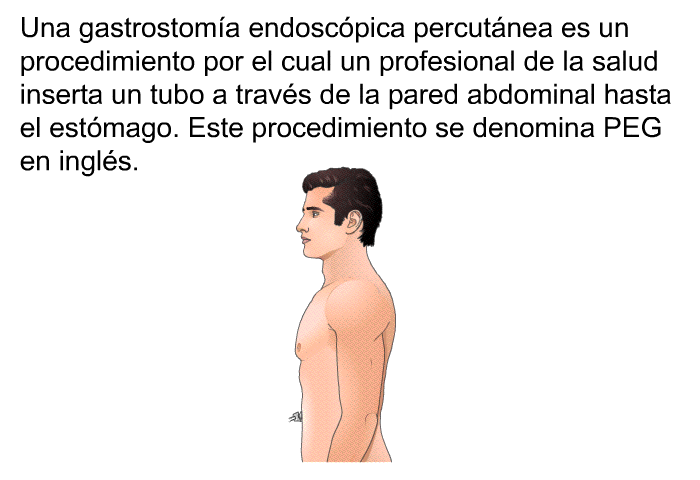 Una gastrostoma endoscpica percutnea es un procedimiento por el cual un profesional de la salud inserta un tubo a travs de la pared abdominal hasta el estmago. Este procedimiento se denomina PEG en ingls.