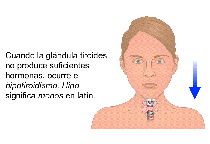 Cuando la glndula tiroides no produce suficientes hormonas, ocurre el <I>hipotiroidismo</I>. <I>Hipo</I> significa <I>menos</I> en latn.