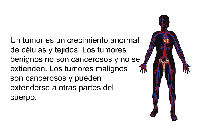 Un tumor es un crecimiento anormal de c�lulas y tejidos. Los tumores benignos no son cancerosos y no se extienden. Los tumores malignos son cancerosos y pueden extenderse a otras partes del cuerpo.